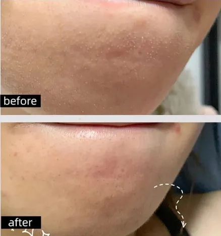 Screenshot 2026-03-25 213924.webp