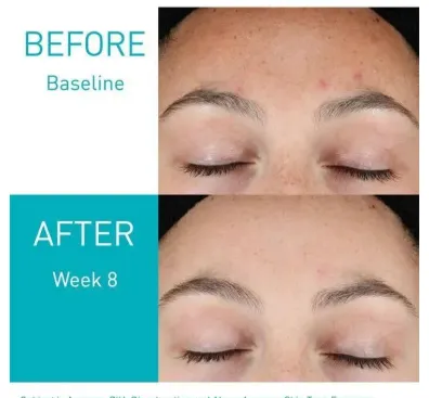 Screenshot 2026-03-25 220519.webp