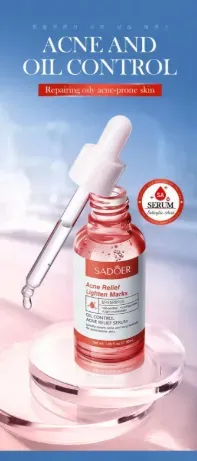 SADOER Salicylic Acid Acne Relief Serum 30ml – Oil Control, Acne Treatment & Dark Spot Remover for Oily, Acne-Prone Skin